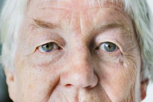 Accent Eye Care portrait-of-white-elderly-woman-closeup-on-eyes-PAP84NJ  