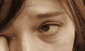 Accent Eye Care eyes-feel_dry  
