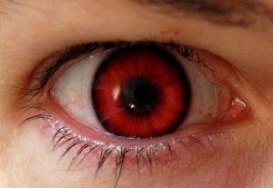 Accent Eye Care Red Eye Glare  