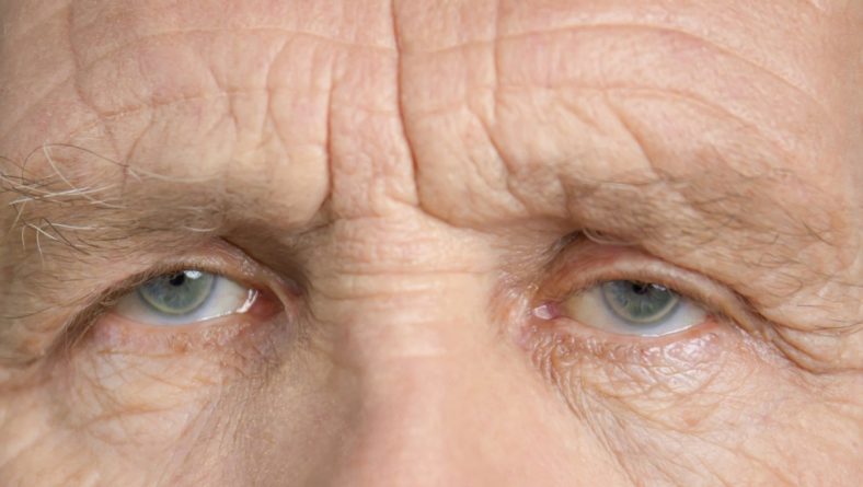 Accent Eye Care Are Your Eyes Feeling Old? 