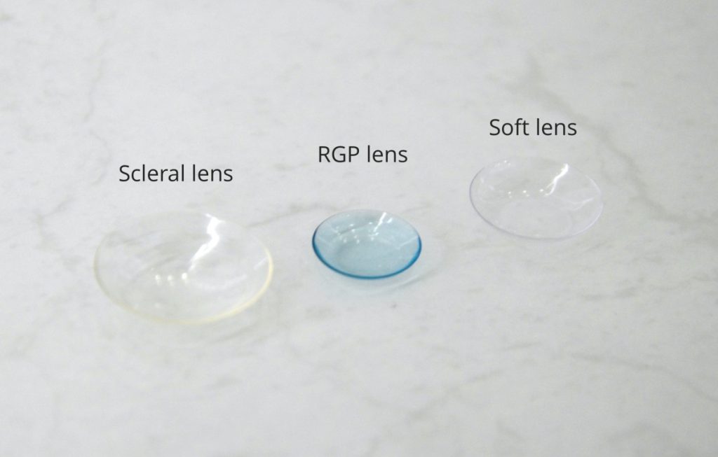 Gas Permeable Contact Lenses